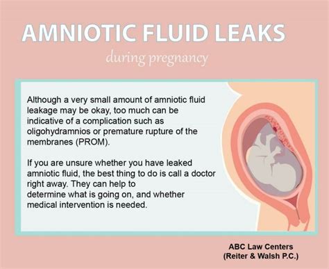 symptoms of leaking amniotic fluid|Water Breaking: What Are the Signs of Leaking。